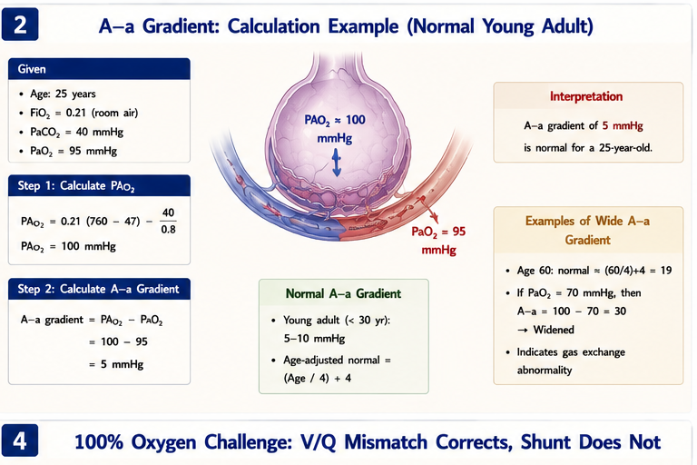 A-a gradient calculation example normal young adult