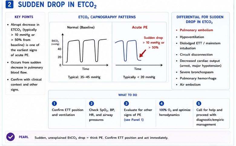 Panel 2 of Acute pulmonary embolism recognition