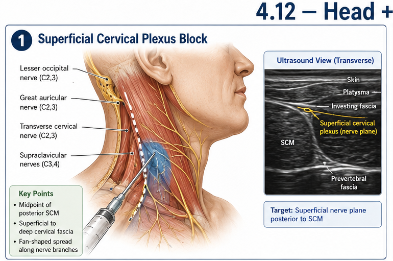 Panel 1 of Cervical nerve blocks