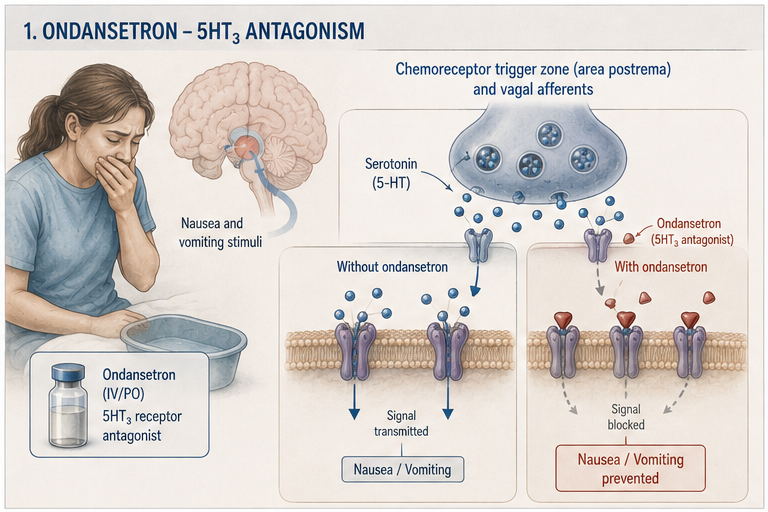 Panel 1 of Ondansetron - SHT2 antagonism