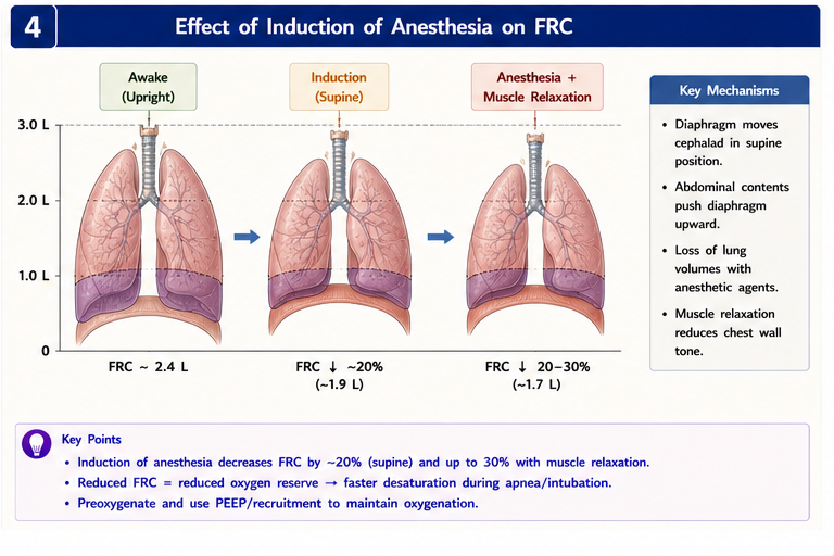 Effects of induction on FRC (~20% drop)